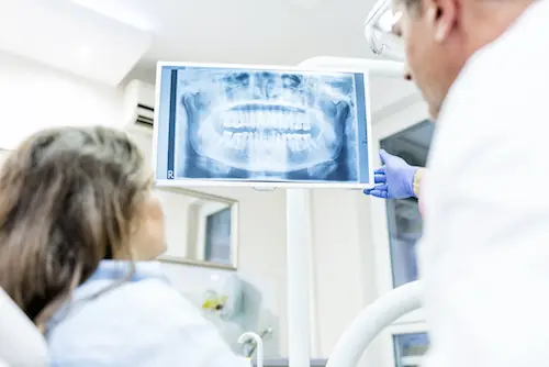 Digital dental X-rays available at Erik P. Cadra Dentistry in Valencia, CA
