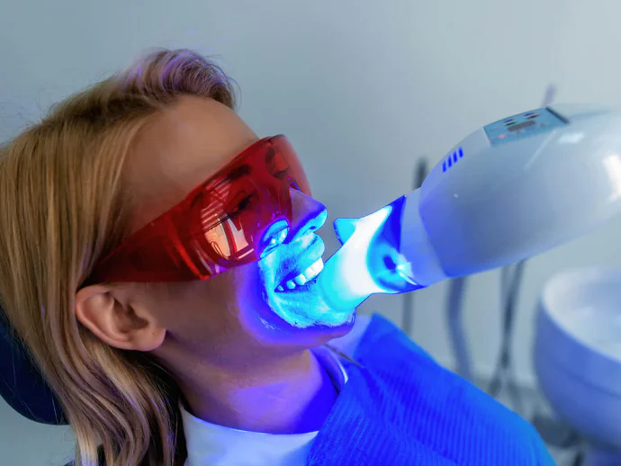 Teeth whitening services available at Erik P. Cadra Dentistry in Valencia, CA